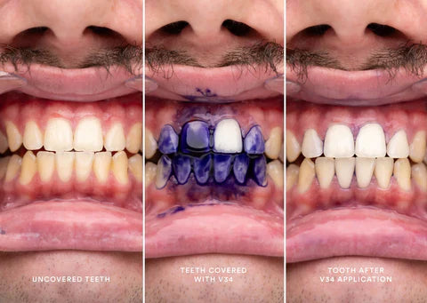 SmileShine™ | Teeth Whitening Serum